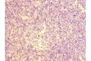 Immunohistochemistry of paraffin-embedded human thymus tissue using ABIN7161343 at dilution of 1:100 (CHRNA1 Antikörper  (AA 25-240))