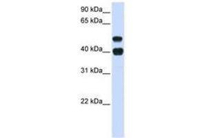 Image no. 1 for anti-Ubiquitin Specific Peptidase 22 (USP22) (AA 72-121) antibody (ABIN6741442) (USP22 Antikörper  (AA 72-121))