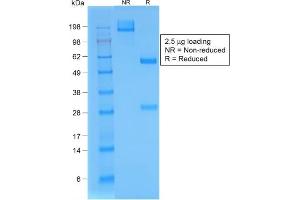 SDS-PAGE Analysis Purified BrdU Rabbit Recombinant Monoclonal Antibody (BRD/1539R). (Rekombinanter BrdU Antikörper)