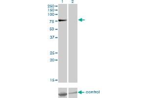 Western blot analysis of TSGA10 over-expressed 293 cell line, cotransfected with TSGA10 Validated Chimera RNAi (Lane 2) or non-transfected control (Lane 1).