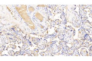 Immunohistochemistry (IHC) image for anti-Hemoglobin antibody (ABIN7437245)