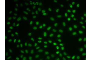 Immunofluorescence (IF) image for anti-Cardiac Troponin C (TNNC1) (AA 1-160) antibody (ABIN6219070) (TNNC1 Antikörper  (AA 1-160))