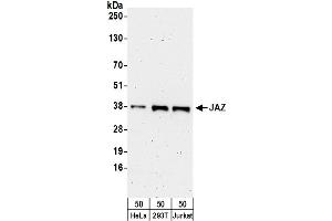 anti-Zinc Finger Protein 346 (ZNF346) (AA 244-294) antibody