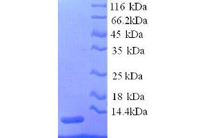 Apolipoprotein C-III (APOC3) (AA 21-101), (full length) protein (His tag)