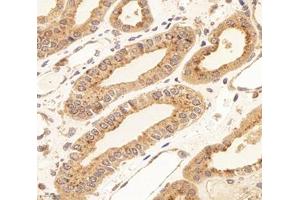 Immunohistochemistry analysis of paraffin-embedded human kidney using,RISC (ABIN7075546) at dilution of 1: 4000 (SCPEP1 Antikörper)