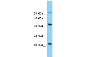 Western Blotting (WB) image for anti-Fatty Acid Binding Protein 5 (Psoriasis-Associated) (FABP5) (C-Term) antibody (ABIN2788321) (FABP5 Antikörper  (C-Term))