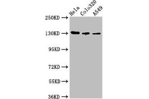 Western Blot Positive WB detected in: Hela whole cell lysate, Colo320 whole cell lysate, A549 whole cell lysate All lanes: ITGAV antibody at 2. (CD51 Antikörper  (AA 775-885))