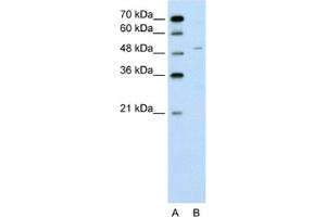 Western Blotting (WB) image for anti-Zinc Finger Protein 19 (ZNF19) antibody (ABIN2462568) (ZNF19 Antikörper)