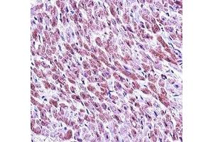 SMAD3 antibody immunohistochemistry analysis in formalin fixed and paraffin embedded human heart tissue. (SMAD3 Antikörper  (AA 127-156))