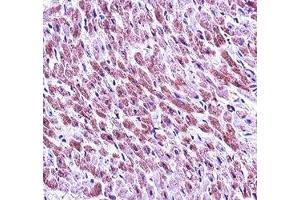 SMAD3 antibody immunohistochemistry analysis in formalin fixed and paraffin embedded human heart tissue.