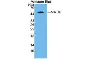 Detection of Recombinant IL28A, Human using Monoclonal Antibody to Interleukin 28A (IL28A) (IL28A Antikörper  (AA 26-200))