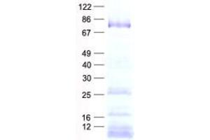 DDX18 Protein (His tag)