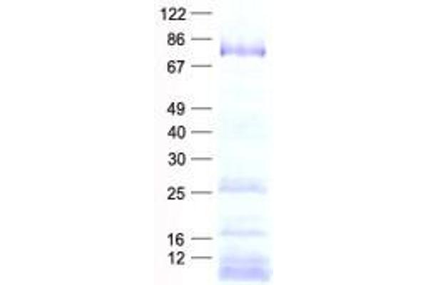 DDX18 Protein (His tag)