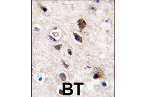 Formalin-fixed and paraffin-embedded human brain tissue reacted with PRKCG polyclonal antibody  , which was peroxidase-conjugated to the secondary antibody, followed by DAB staining . (PKC gamma Antikörper  (C-Term))