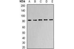 Western blot analysis of APEH expression in Jurkat (A), HepG2 (B), mouse liver (C), mouse kidney (D), rat bone marrow (E) whole cell lysates. (APEH Antikörper)