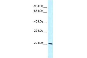 WB Suggested Anti-Laptm4b Antibody Titration: 1. (LAPTM4B Antikörper  (C-Term))