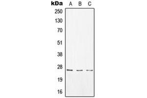 Western blot analysis of CD8a expression in A549 (A), Raw264. (CD8 alpha Antikörper  (Center))