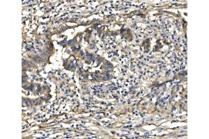IHC analysis of PDE6 beta/PDE6B using anti-PDE6 beta/PDE6B antibody (ABIN7600894). (PDE6B Antikörper  (AA 25-237))