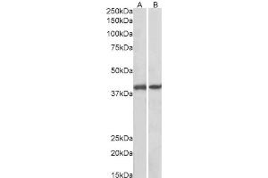 Western Blotting (WB) image for anti-Guanine Nucleotide Binding Protein (G Protein), Q Polypeptide (GNAQ) (AA 162-175) antibody (ABIN625823)