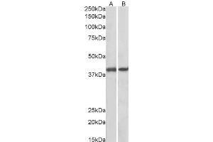 ABIN625823 (0. (GNAQ Antikörper  (AA 162-175))
