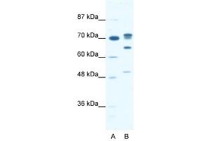 DDX21 antibody used at 0. (DDX21 Antikörper)