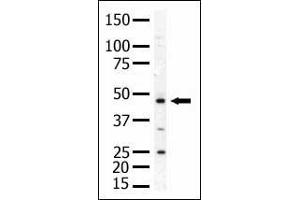Antibody is used in Western blot to detect PIP5K2A in mouse skeletal muscle tissue lysate. (PIP4K2A Antikörper  (N-Term))
