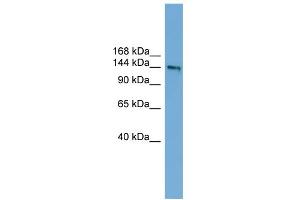 WB Suggested Anti-DCC Antibody Titration:  0. (DCC Antikörper  (Middle Region))