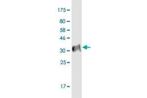 Western Blot detection against Immunogen (34. (P2RX2 Antikörper  (AA 128-205))