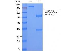 SDS-PAGE Analysis Serum Amyloid A Rabbit Recombinant Monoclonal Antibody (SAA/2868R). (Rekombinanter SAA Antikörper)