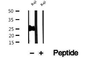 Western blot analysis of extracts of Raji cells, using PCMT1 antibody. (PCMT1 Antikörper  (Internal Region))