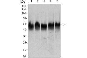 Western Blotting (WB) image for anti-Tubulin, beta 2A (TUBB2A) (AA 25-187) antibody (ABIN1846607)