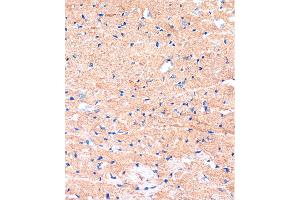 Immunohistochemistry of paraffin-embedded Mouse heart using ME3 Rabbit pAb (ABIN7268384) at dilution of 1:100 (40x lens). (ME3 Antikörper  (AA 505-604))