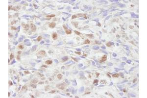Immunohistochemistry (IHC) image for anti-Nuclear Receptor Coactivator 2 (NCOA2) (C-Term) antibody (ABIN7448683)