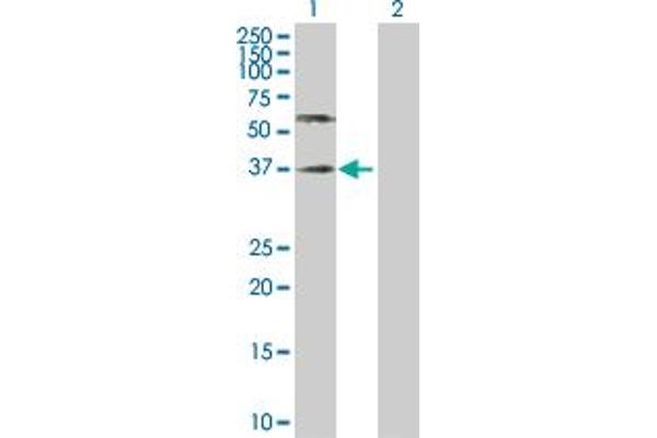 Poliovirus Receptor Antikörper  (AA 1-417)