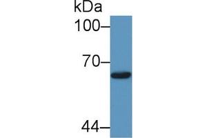 Western blot analysis of Human 293T cell lysate, using Cow Smad1 Antibody (1 µg/ml) and HRP-conjugated Goat Anti-Rabbit antibody ( (SMAD1 Antikörper  (AA 270-465))