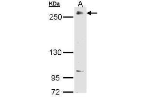 WB Image Sample (30 ug of whole cell lysate) A: 293T 5% SDS PAGE antibody diluted at 1:2000 (POLR2A/RPB1 Antikörper  (C-Term))
