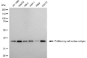 Western blotting analysis using Proliferating cell nuclear antigen antibody (ABIN7799915). (PCNA Antikörper)