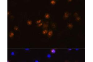 Immunofluorescence analysis of L929 cells using SWAP70 Polyclonal Antibody at dilution of 1:100. (SWAP70 Antikörper)