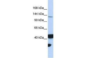 MLH3 antibody used at 1 ug/ml to detect target protein. (MLH3 Antikörper)