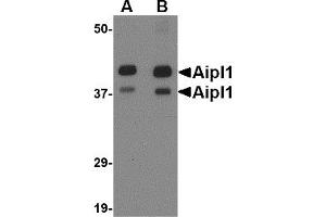 Western Blotting (WB) image for anti-Aryl Hydrocarbon Receptor Interacting Protein-Like 1 (AIPL1) (Middle Region) antibody (ABIN1030848) (AIPL1 Antikörper  (Middle Region))