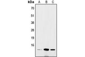 Western blot analysis of BRI3 expression in Hela (A), mouse brain (B), rat colon (C) whole cell lysates.