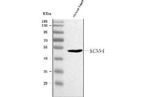 Western blot analysis of Kcnn4 using anti-Kcnn4 antibody (ABIN7601329).