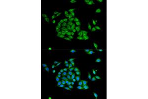 Immunofluorescence analysis of HeLa cells using PICK1 antibody. (PICK1 Antikörper)