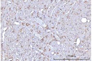 IHC analysis of RAP1GAP using anti-RAP1GAP antibody (ABIN7599729). (RAP1GAP Antikörper  (AA 11-661))