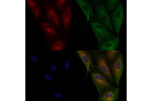 ABIN6265844 and ABIN6276978 staining  cells by IF/ICC. (UBE2D1 Antikörper  (C-Term))