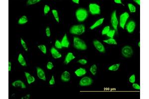 Immunofluorescence (IF) image for anti-Ribosomal Protein S23 (RPS23) (AA 44-143) antibody (ABIN519911)