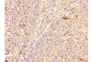 Immunohistochemistry of paraffin-embedded human tonsil tissue using ABIN7147978 at dilution of 1:100 (CD3A (AA 18-180) Antikörper)