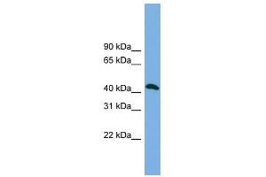 ANKMY2 antibody used at 1 ug/ml to detect target protein. (ANKMY2 Antikörper  (N-Term))