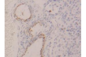 DAB staining on IHC-P; Samples: Rat Ovary Tissue (KRT4 Antikörper  (AA 317-454))