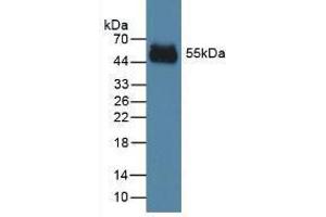 Western blot analysis of the recombinant protein. (Kaninchen anti-Human IgG2 Antikörper)